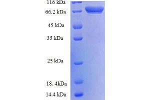 SDS-PAGE (SDS) image for Transglutaminase 2 (C Polypeptide, Protein-Glutamine-gamma-Glutamyltransferase) (TGM2) (AA 4-544), (Isoform 2) protein (His-SUMO Tag) (ABIN4976219) (Transglutaminase 2 Protein (AA 4-544, Isoform 2) (His-SUMO Tag))