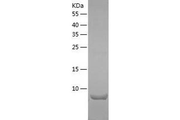 CCL28 Protein (AA 20-130) (His tag)