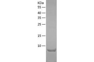 Western Blotting (WB) image for Chemokine (C-C Motif) Ligand 28 (CCL28) (AA 20-130) protein (His tag) (ABIN7122296) (CCL28 Protein (AA 20-130) (His tag))