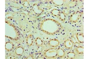 Immunohistochemistry of paraffin-embedded human kidney tissue using ABIN7170991 at dilution of 1:100 (SOCS1 antibody  (AA 1-211))