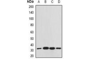 Western Blotting (WB) image for anti-Guanine Nucleotide Binding Protein (G Protein), beta Polypeptide 2-Like 1 (GNB2L1) antibody (ABIN7307828)