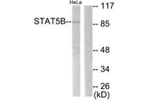 Western Blotting (WB) image for anti-Signal Transducer and Activator of Transcription 5B (STAT5B) (AA 697-746) antibody (ABIN2888609) (STAT5B antibody  (AA 697-746))