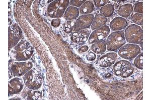 IHC-P Image RPSA antibody [N1C3] detects RPSA protein at cytoplasm on mouse small intestine by immunohistochemical analysis. (RPSA/Laminin Receptor antibody)