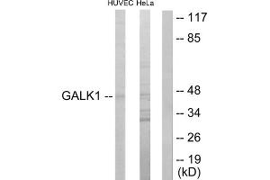 Western blot analysis of extracts from HUVEC cells and HeLa cells, using GALK1 antibody. (GALK1 antibody  (N-Term))