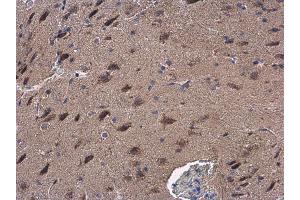 IHC-P Image GOT2 antibody detects GOT2 protein at cytoplasm in mouse brain by immunohistochemical analysis. (GOT2 antibody  (Center))