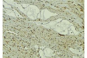 ABIN6277334 at 1/100 staining Mouse muscle tissue by IHC-P. (FBXO32 antibody  (N-Term))