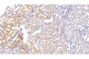 Detection of FXR in Rat Kidney Tissue using Polyclonal Antibody to Farnesoid X Receptor (FXR) (NR1H4 antibody  (AA 375-568))