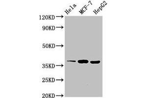 Western Blot Positive WB detected in: Hela whole cell lysate, MCF-7 whole cell lysate, HepG2 whole cell lysate All lanes: ALX1 antibody at 3 μg/mL Secondary Goat polyclonal to rabbit IgG at 1/50000 dilution Predicted band size: 37 kDa Observed band size: 37 kDa (ALX1 antibody  (AA 10-304))