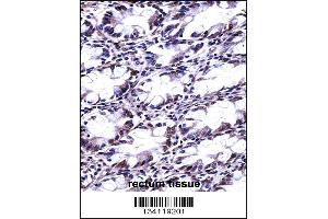 CFL2 Antibody immunohistochemistry analysis in formalin fixed and paraffin embedded human rectum tissue followed by peroxidase conjugation of the secondary antibody and DAB staining. (Cofilin 2 antibody  (N-Term))