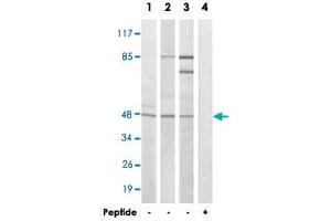 Western blot analysis of extracts from HeLa cells (Lane 1 and lane 4), LoVo cells (Lane 2) and A-549 cells (Lane 3), using FOXB2 polyclonal antibody .