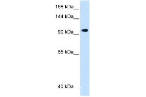 WB Suggested Anti-SEC63 Antibody Titration:  1. (SEC63 antibody  (C-Term))