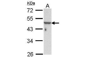 WB Image Sample (30 ug of whole cell lysate) A: Hela 10% SDS PAGE antibody diluted at 1:1000 (Keratin 33B antibody)