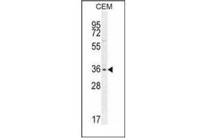 Western blot analysis of Musashi-1 Antibody (N-term) in CEM cell line lysates (35ug/lane). (MSI1 antibody  (N-Term))