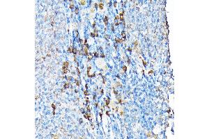 Immunohistochemistry of paraffin-embedded mouse spleen using ETFA Rabbit pAb  at dilution of 1:200 (40x lens). (ETFA antibody  (AA 1-333))