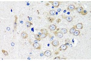 Immunohistochemistry of paraffin-embedded Rat brain using TSC2 Polyclonal Antibody at dilution of 1:200 (40x lens). (Tuberin antibody)
