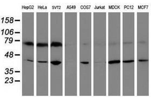 CRYZL1 antibody