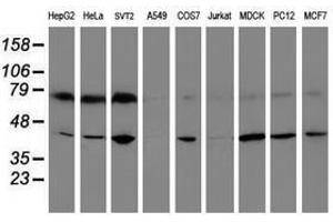 Image no. 2 for anti-Crystallin, Zeta, Homolog antibody (ABIN1497655)
