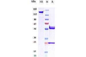 Anti-Amyloid Beta Reference Antibody (DLX212) on SDS-PAGE under reducing (R) condition.