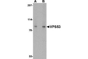 Western Blotting (WB) image for anti-Vacuolar Protein Sorting 53 Homolog (VPS53) (C-Term) antibody (ABIN1030797) (VPS53 antibody  (C-Term))