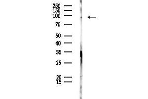 anti-EF-Hand Calcium Binding Domain 4B (EFCAB4B) (N-Term) antibody