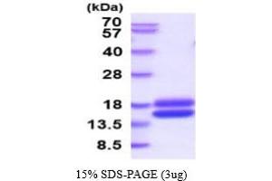 SDS-PAGE (SDS) image for Cystatin C (CST3) (AA 21-140) (Active) protein (His tag) (ABIN5777481)