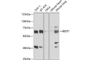 Western blot analysis of extracts of various cell lines, using BEST1 antibody (ABIN6127516, ABIN6137535, ABIN6137537 and ABIN6221403) at 1:1000 dilution. (Bestrophin 1 antibody  (AA 376-585))