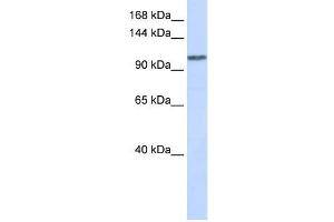 WDR63 antibody used at 1 ug/ml to detect target protein. (WDR63 antibody  (Middle Region))