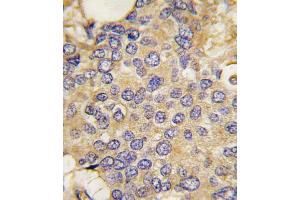 Formalin-fixed and paraffin-embedded human Testis tissue reacted with hSMURF1-W81 (ABIN388828 and ABIN2850430) , which was peroxidase-conjugated to the secondary antibody, followed by AEC staining. (SMURF1 antibody  (N-Term))