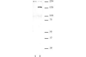 SMC1 phospho Ser957 pAb tested by Western blot. (SMC1A antibody  (pSer957))