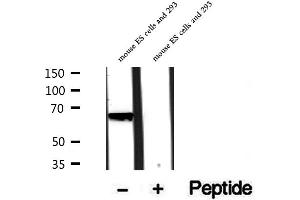 Western blot analysis of extracts of rat brain tissue, using PHF19 antibody. (PHF19 antibody  (Internal Region))