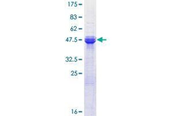 ASF1A Protein (AA 1-204) (GST tag)