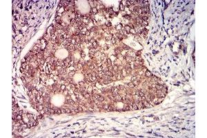Immunohistochemistry (IHC) image for anti-Interleukin 6 Signal Transducer (Gp130, Oncostatin M Receptor) (IL6ST) (AA 73-231) antibody (ABIN7193398)