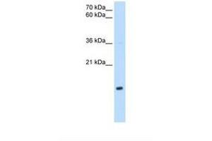 Image no. 1 for anti-NADH Dehydrogenase (Ubiquinone) 1 beta Subcomplex, 5, 16kDa (NDUFB5) (AA 69-118) antibody (ABIN6738155) (NDUFB5 antibody  (AA 69-118))
