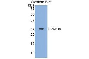 Western Blotting (WB) image for anti-Spectrin alpha Chain, Brain (SPTAN1) (AA 402-599) antibody (ABIN1172704) (SPTAN1 antibody  (AA 402-599))