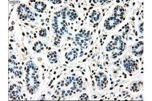 Immunohistochemical staining of paraffin-embedded breast tissue using anti-MAP2K4 mouse monoclonal antibody. (MAP2K4 antibody)