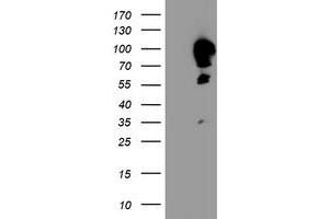 HEK293T cells were transfected with the pCMV6-ENTRY control (Left lane) or pCMV6-ENTRY CAST (Right lane) cDNA for 48 hrs and lysed. (Calpastatin antibody)