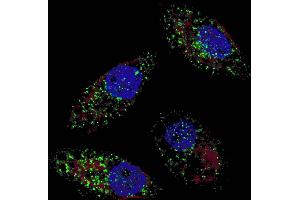 Fluorescent image of  cells stained with cleaved LC3B antibody. (LC3B antibody  (cleaved))