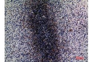 Immunohistochemistry (IHC) image for anti-CD79b Molecule, Immunoglobulin-Associated beta (CD79B) (Internal Region) antibody (ABIN6287313)