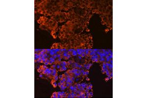 Immunofluorescence analysis of rat pituitary gland cells using GHRHR Rabbit pAb (ABIN6127953, ABIN6141077, ABIN6141078 and ABIN6224478) at dilution of 1:100 (40x lens). (GHRHR antibody  (AA 1-130))