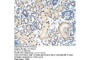 Rabbit Anti-ANP32A Antibody  Paraffin Embedded Tissue: Human Kidney Cellular Data: Epithelial cells of renal tubule Antibody Concentration: 4. (PHAP1 antibody  (Middle Region))