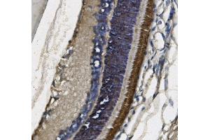 IHC analysis of PDE6 beta/PDE6B using anti-PDE6 beta/PDE6B antibody (ABIN7600893). (PDE6B antibody  (AA 25-237))