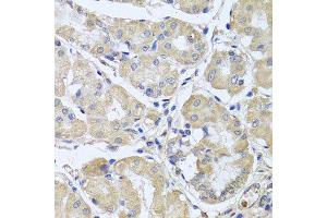 Immunohistochemistry of paraffin-embedded human gastric using CEP57L1 antibody at dilution of 1:100 (x40 lens). (CEP57L1 antibody)