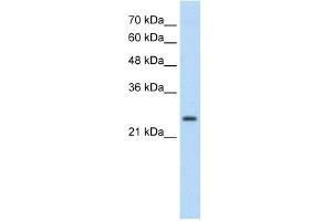 TSHR antibody used at 0. (TSH receptor antibody  (C-Term))