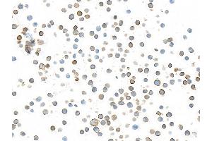 Immunocytochemistry (ICC) image for anti-CD226 (CD226) (AA 19-229) antibody (ABIN7455092) (Recombinant CD226 antibody  (AA 19-229))