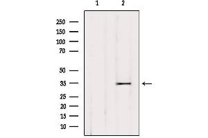 Western blot analysis of extracts from HUVEC, using OR52L2 Antibody.