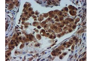 Image no. 5 for anti-Metalloproteinase Inhibitor 2 (TIMP2) antibody (ABIN1501393)
