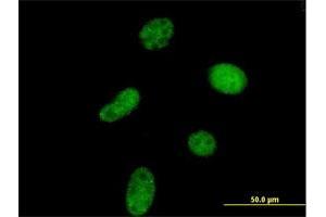 Immunofluorescence (IF) image for anti-Uridine-Cytidine Kinase 1-Like 1 (UCKL1) (AA 1-419) antibody (ABIN950088)