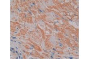 IHC-P analysis of Human Tissue, with DAB staining. (NFAT1 antibody  (AA 392-574))