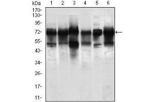 Western blot analysis using WHSC2 mouse mAb against Jurkat (1), HeLa (2), HEK293 (3), A549 (5), SPC-A-1 (6) cell lysate, and Rat brain (4) tissue lysate. (WHSC2 antibody  (AA 280-511))