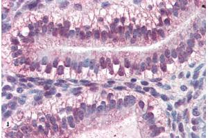 Human Uterus (formalin-fixed, paraffin-embedded) stained with CRABP2 antibody ABIN364443 at 10 ug/ml followed by biotinylated anti-mouse IgG secondary antibody ABIN481714, alkaline phosphatase-streptavidin and chromogen. (CRABP2 antibody  (AA 1-138))